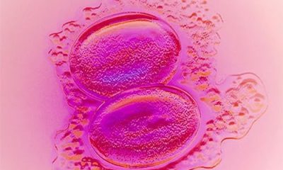 embryo4_500x375-400×240
