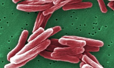 mycobacterium-tuberculosis-400×240