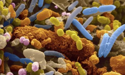 gut-bacteria-400×240